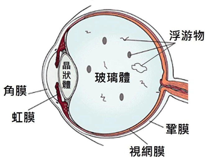 玻璃体视网膜