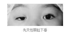眼眶病