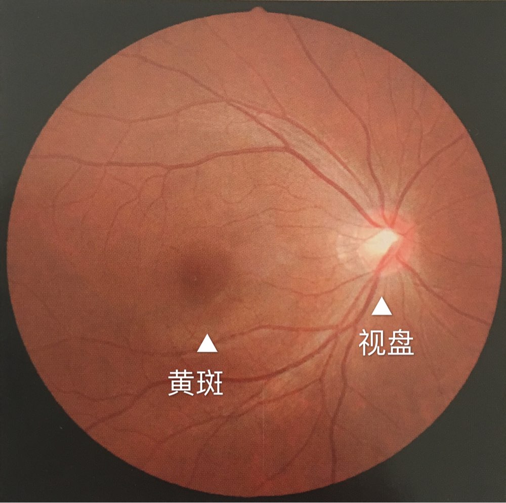 玻璃体视网膜
