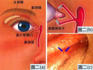 眼表眼角膜