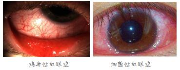 眼表眼角膜