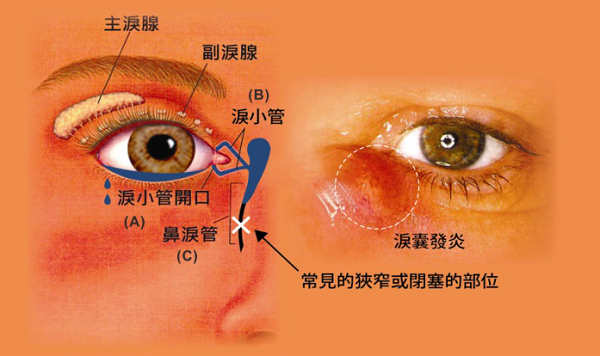 眼眶病