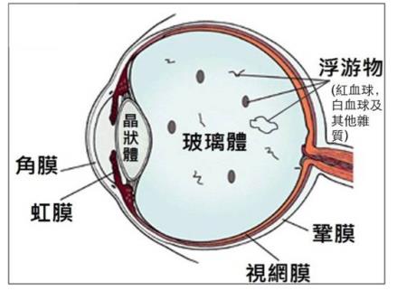 玻璃体视网膜