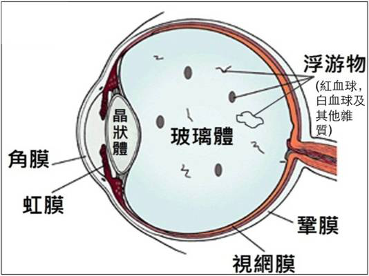 玻璃体视网膜