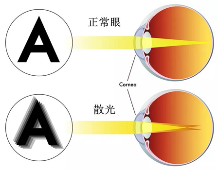 小儿眼病