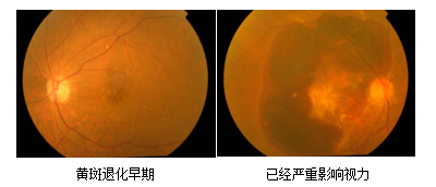 玻璃体视网膜