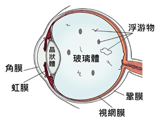 玻璃体视网膜