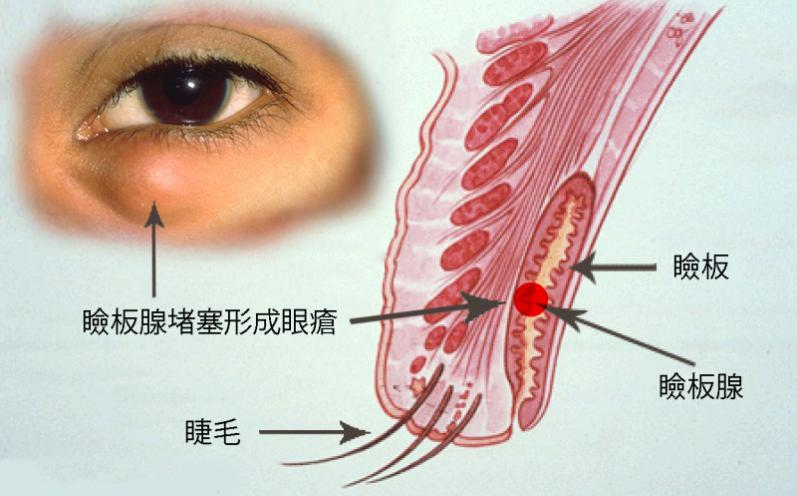 眼表眼角膜